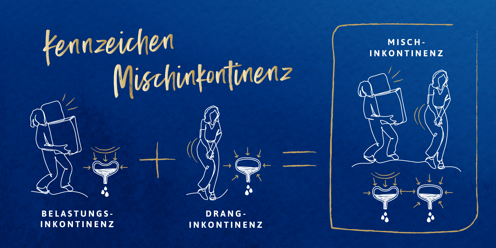 Illustration der Kennzeichen einer Mischinkontinenz Illustration der Kennzeichen einer Mischinkontinenz